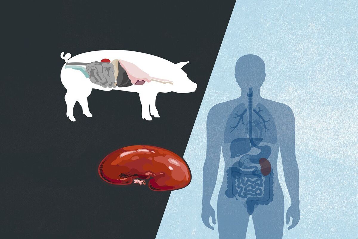 Pig to Human Transplants May Be Possible In Future