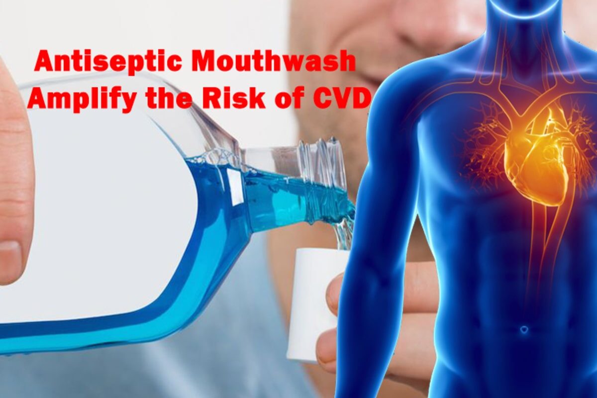 Antiseptic Mouthwash Kills Beneficial Bacteria and Increased the Risk of CVD