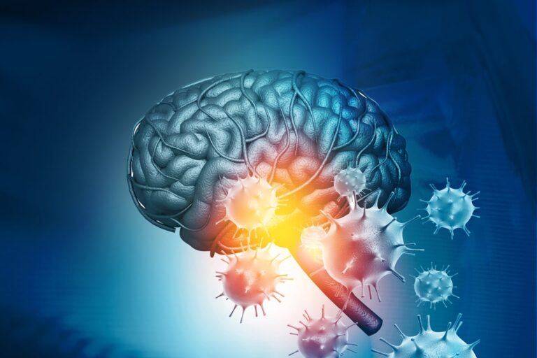 Rituximab An Effective Secondary Option In Autoimmune Limbic 