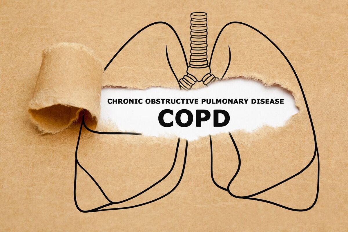 COPD Exacerbations – Beta Blockers May Be a Favorable Option