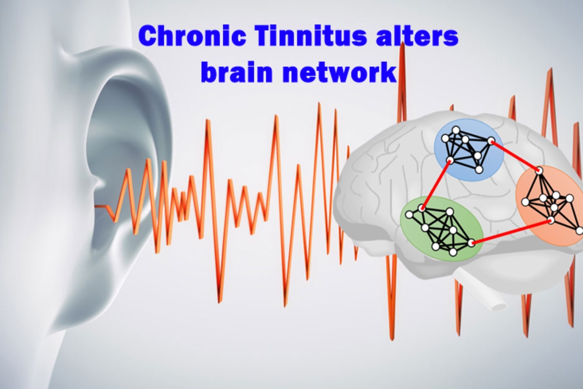 Chronic Tinnitus alters brain network