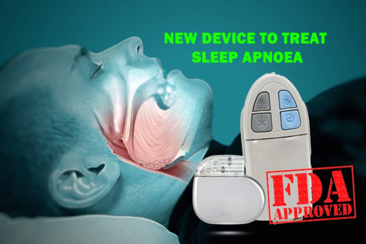 New Device to Treat Sleep Apnoea