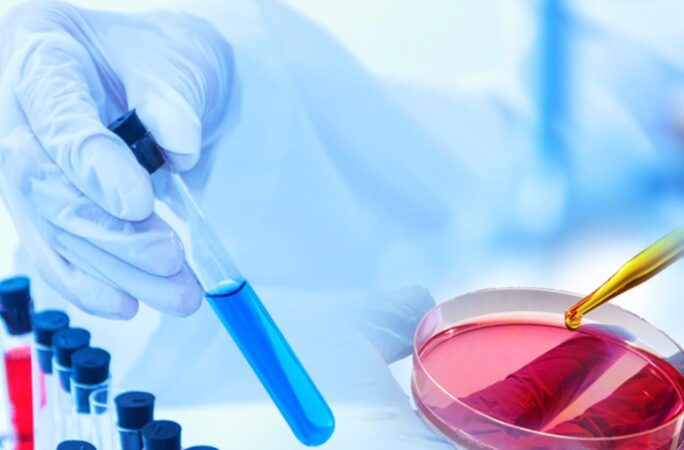 New Ultrafast Antibiotic Resistance Test developed